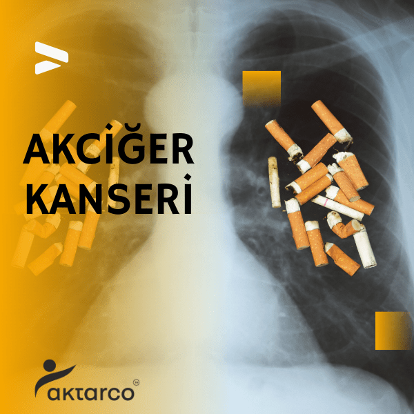 akciğer kanseri belirtileri, akciğer kanser belirtileri, akciğer kanseri, akciğer kanser, akciğer,