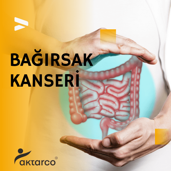 bağırsak kanseri, kolon kanseri nedir, kalın bağırsak kanseri belirtileri, kalın bağırsak kanserinin belirtileri, 