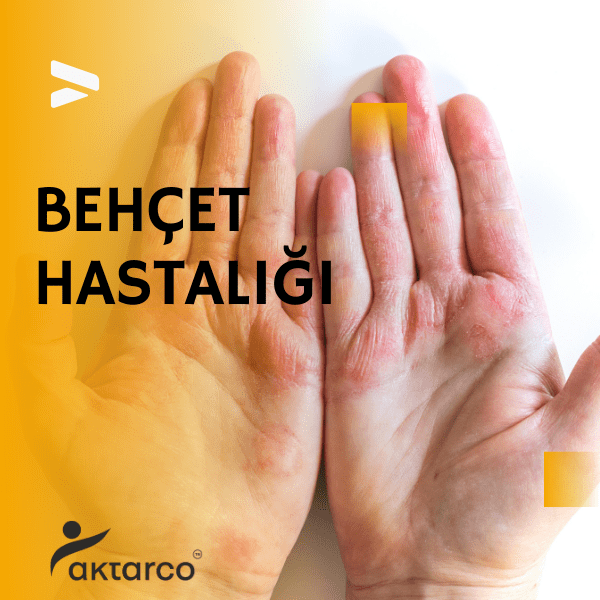 behçet hastalığı, behcet hastasi, behcethastaligi, behçet hastalığı nedir, behçet hastalığı belirtileri, behçet, 