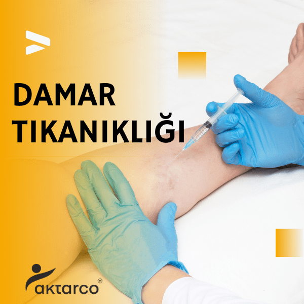 damar tıkanıklığı belirtileri, kalp damar tıkanıklığı belirtileri, damar tıkanıklığı, damartikanikligi, bacak damar tıkanıklığı belirtileri, 