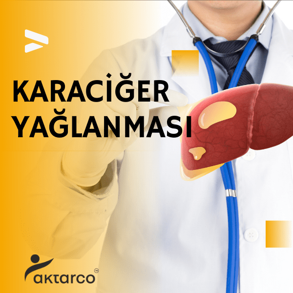 karaciğer yağlanması, karaciğer yağlanması belirtileri, karaciğer yağlanmasının belirtileri, hepatosteatoz,